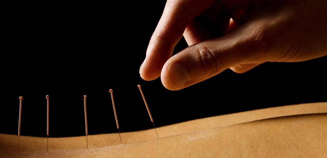 Chinese Medicine and Acupuncture Spirit Gate Medicine